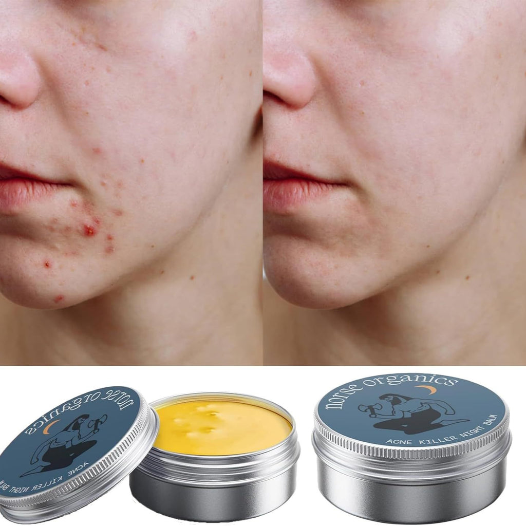 Noise Organics Blemish Care Cream, Muscle Body Skin Moisturizing Cream