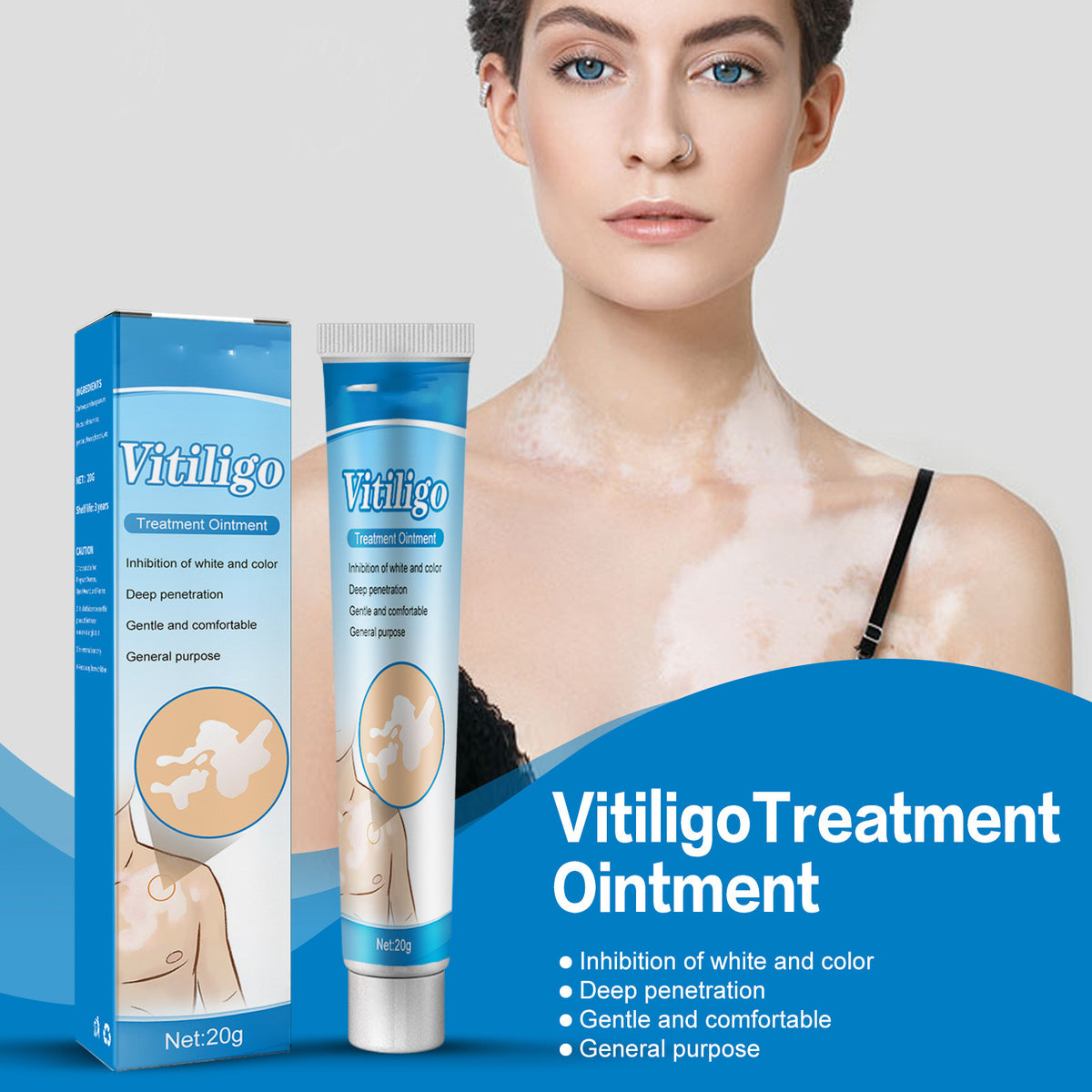 Vitiligo Nursing Efficacy On Skin Cream